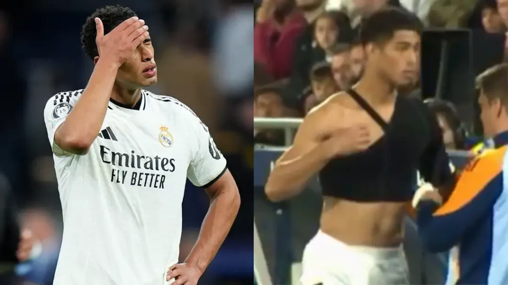 Jude Bellingham Set for Shoulder Surgery